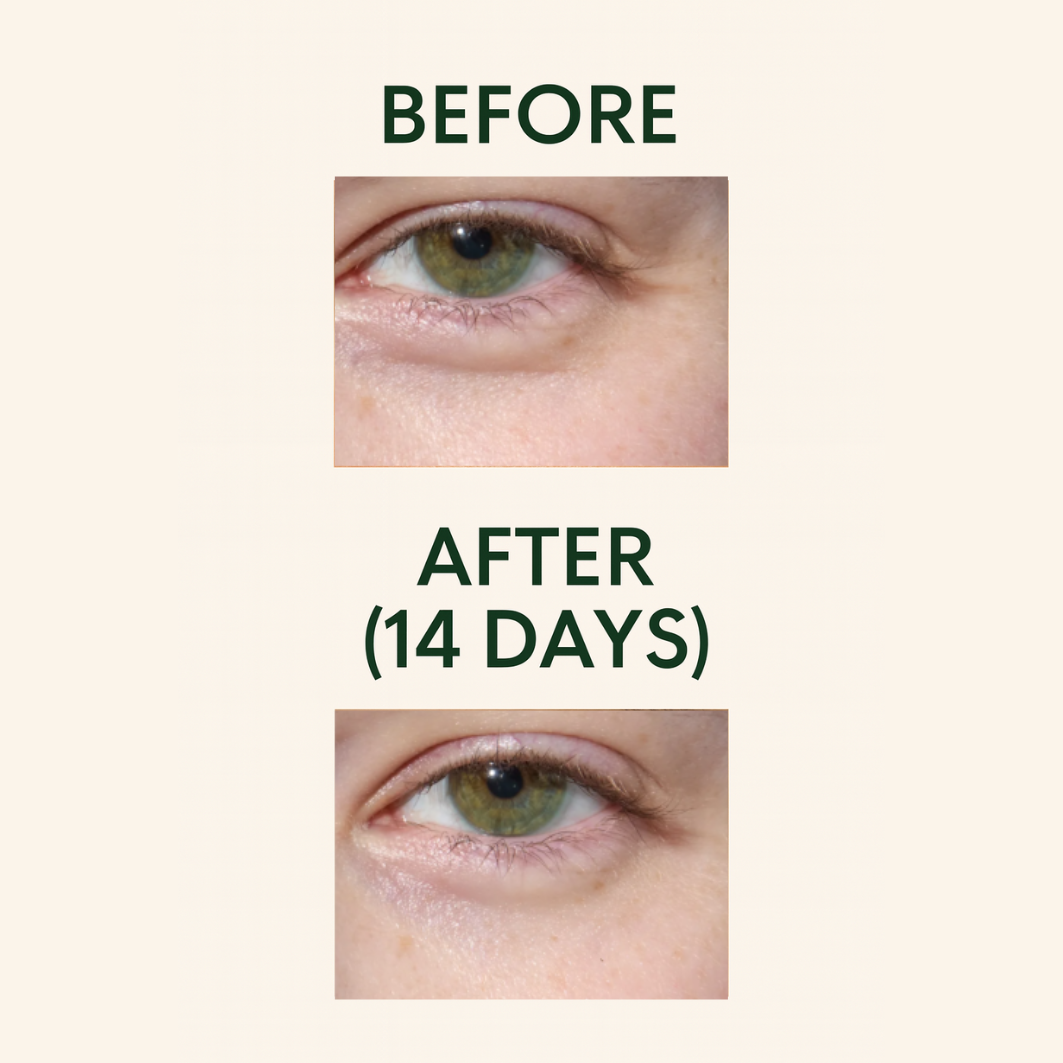 Avocado Glow Eye Masks